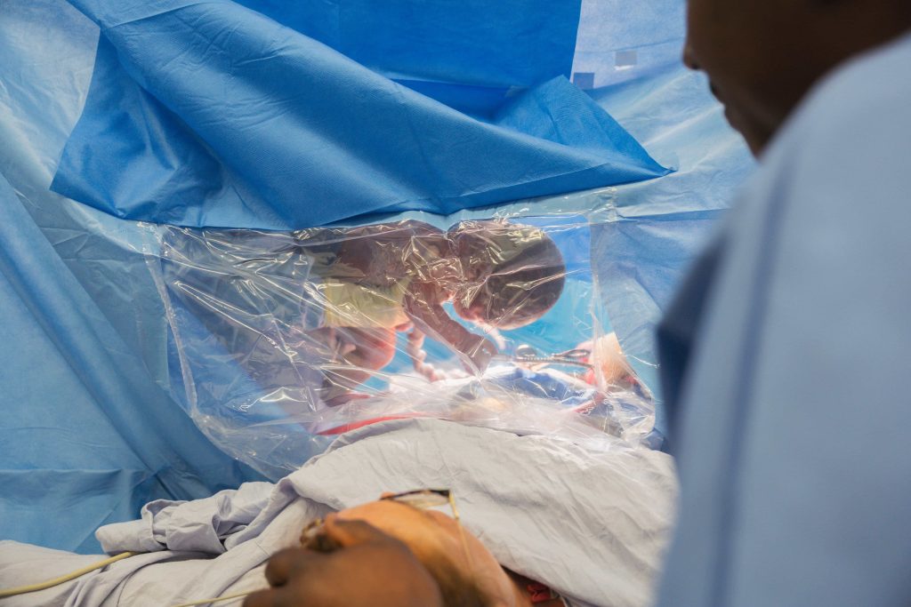 Reportage photo au bloc opératoire d'une clinique privée par un photographe médical professionnel. Reportage photo au bloc opératoire d'une clinique privée par un photographe médical professionnel.